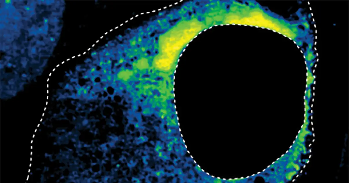 AI sorts cell droplets into four shapes, uncovering drug effects in human cells