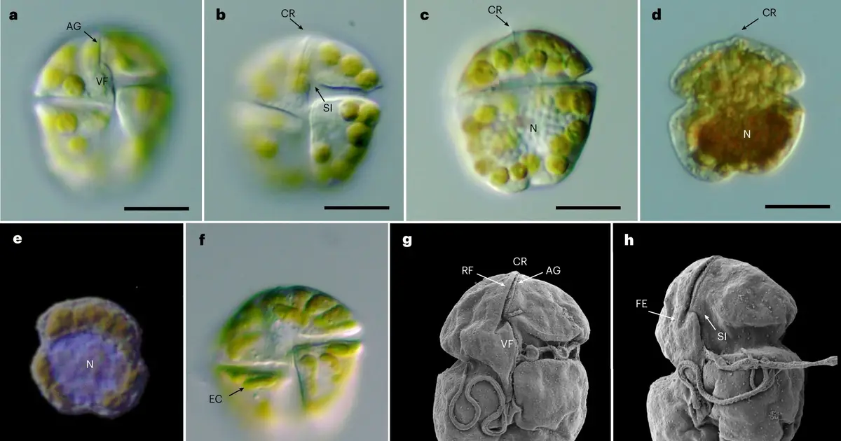 South Australian algal bloom species the world's most toxic harmful microalga yet recorded