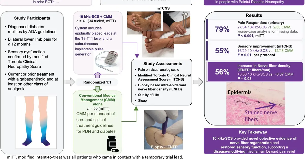 Spinal cord stimulation eases pain and improves sensation in people with diabetic nerve damage