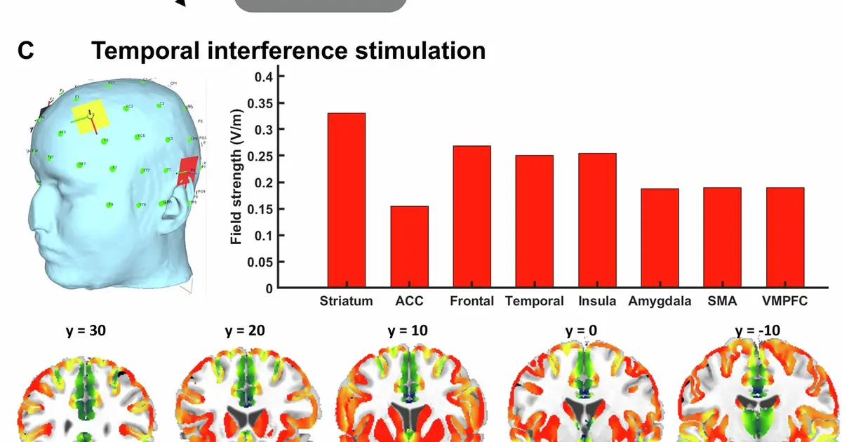 Stimulating the striatum changes how people weigh mental effort against rewards