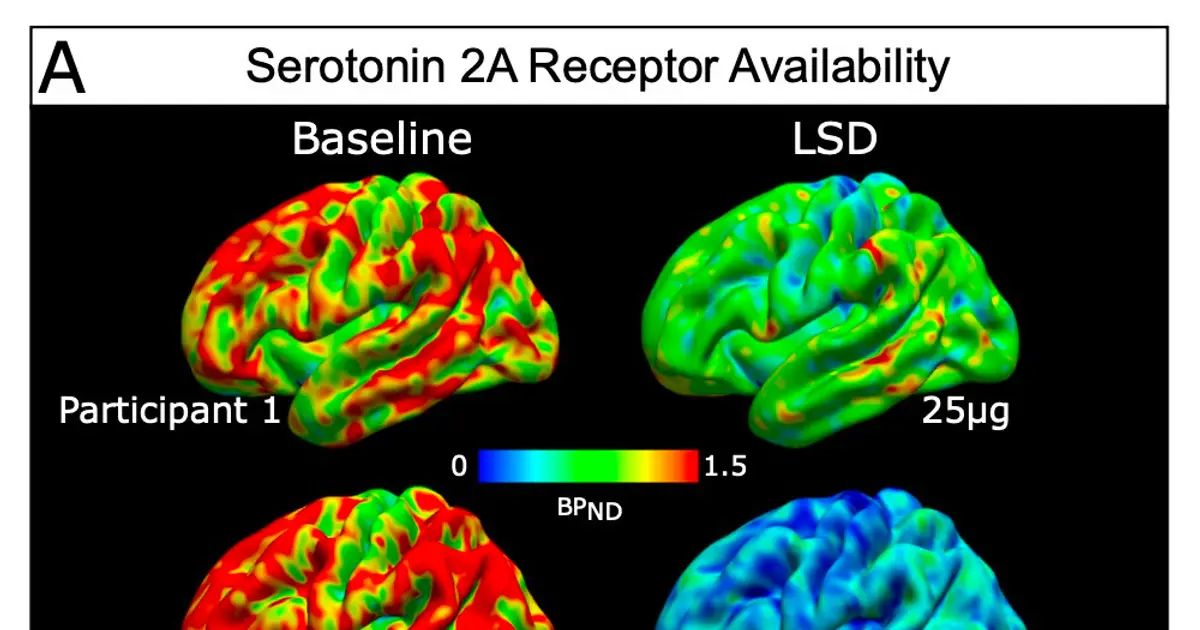 LSD and psilocybin push brain blood flow in opposite directions, study suggests