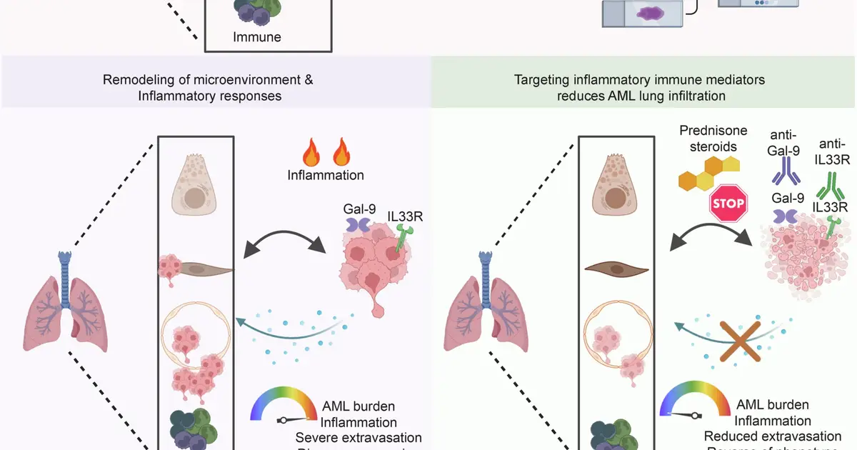 Study reveals how leukemia cells enter and damage lungs