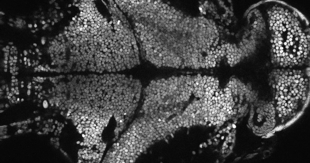 These tiny genetic fragments may be critical for telling a brain when to rest