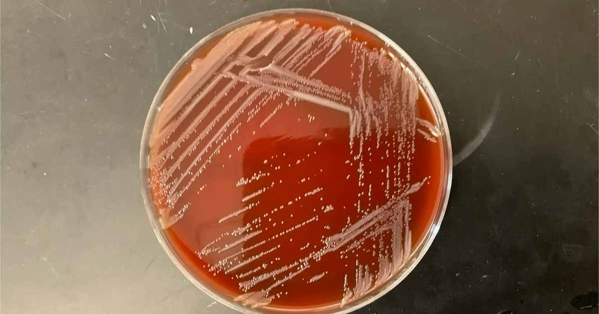 Q&A: Why scientists are studying a microbe they found in a sink
