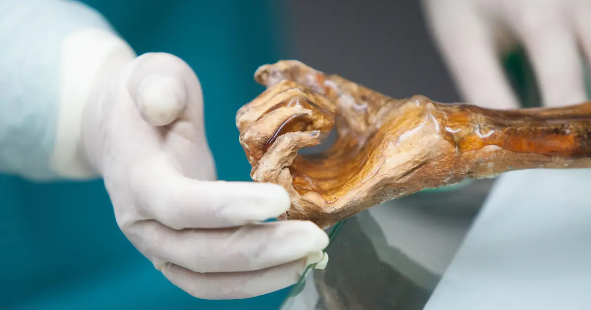 Ötzi the Iceman and his microbiome—a 5,300-year-old relationship