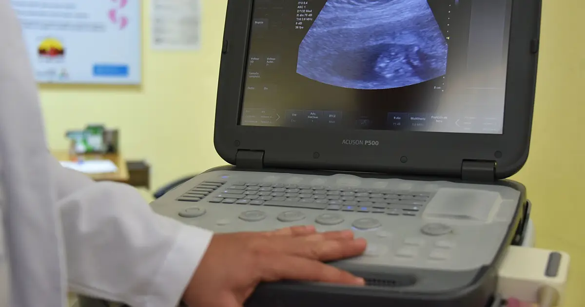 New global safety guidelines for diagnostic ultrasound