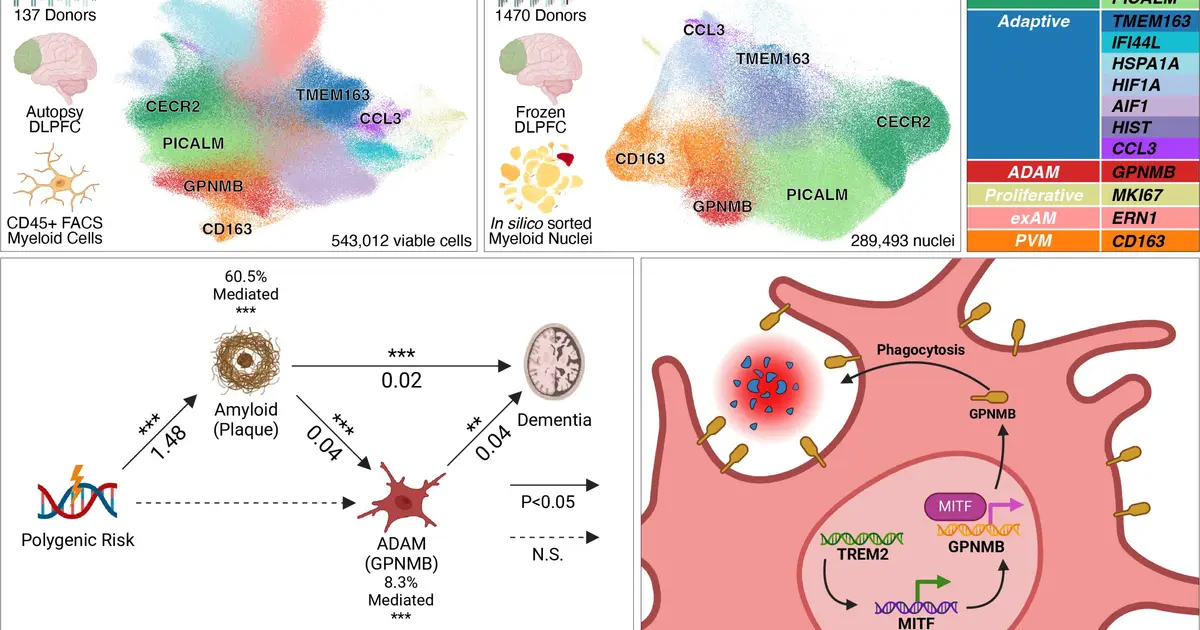 Brain immune cell map explains how defenses shift during Alzheimer's progression