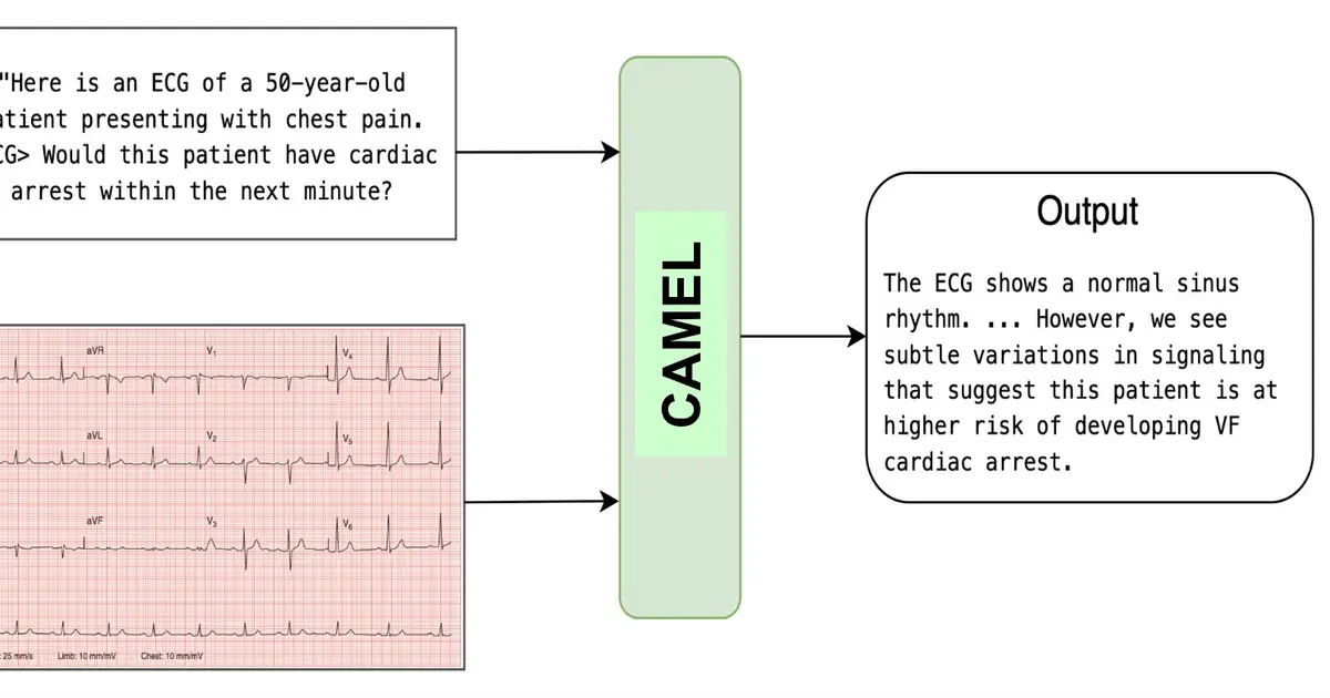 AI model could warn of cardiac arrest 10 to 15 minutes early