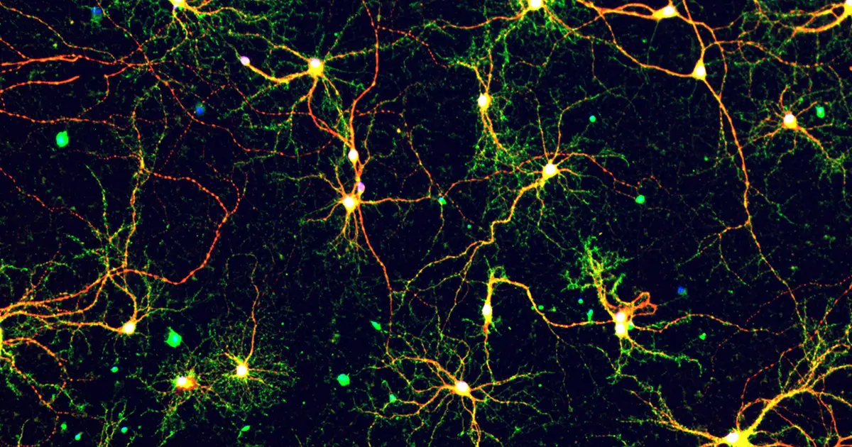 Atomic view of Alzheimer's disease peptide could inform new drugs