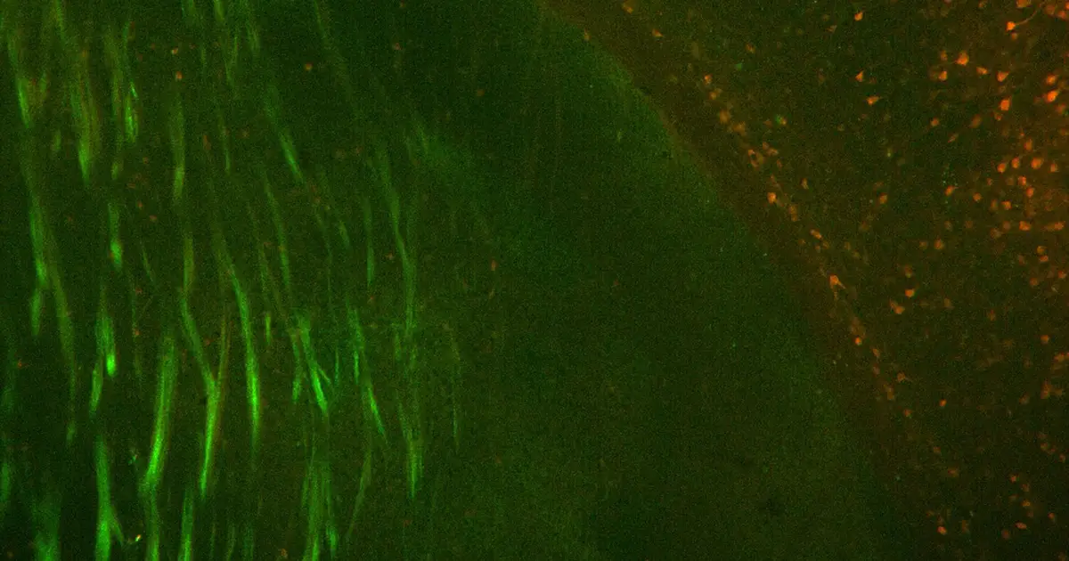 How severe illness during pregnancy sometimes alters neurodevelopment