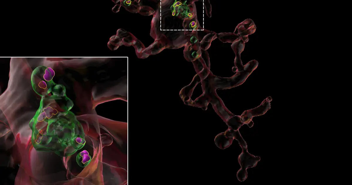 Youth-associated protein helps restore healthy function in immune cells in the aging brain