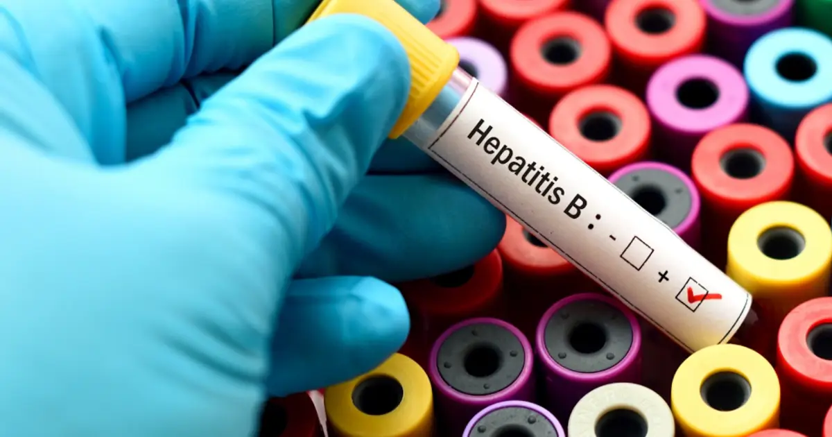 CDC to Conduct Hepatitis B Vaccine Trial in Guinea - Bissau , Raising Ethical Concerns