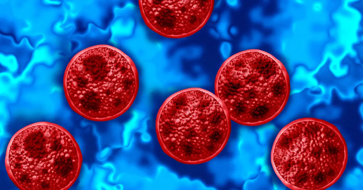 FDA Still Investigating Diarrhea-Causing Parasite, as Cyclospora Outbreak Continues