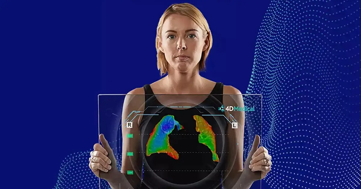 4DMedical scores $100M for US expansion of lung imaging SaaS and more briefs