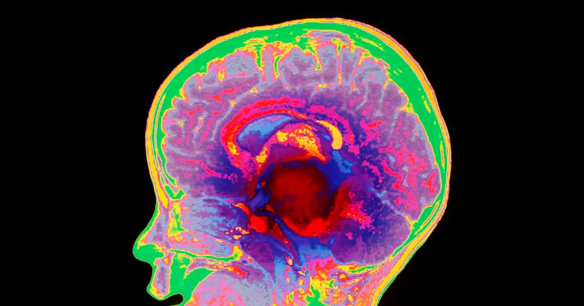 Four children with terminal brain cancer saved by new cell therapy