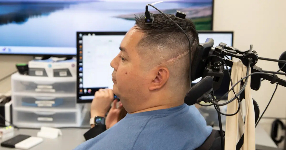 Neurostimulation restores feeling in paralysed hand for months after