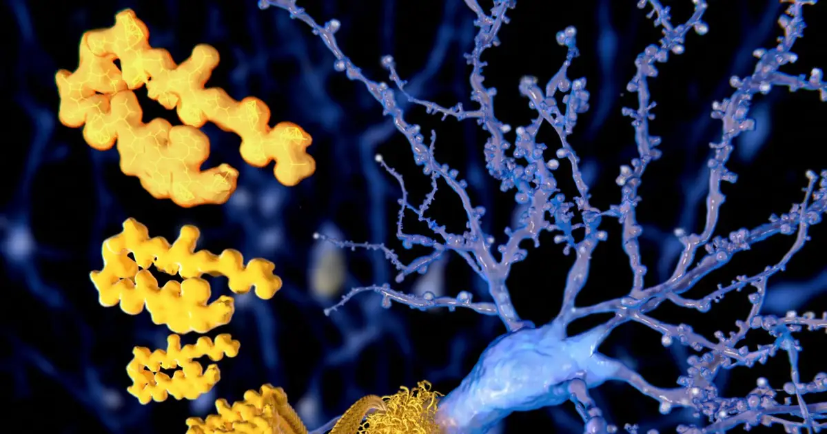 Game that reduces dementia risk may clear amyloid from men’s brains