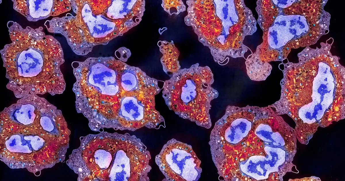 Restoring ability to remove zombie cells may keep us sharp as we age