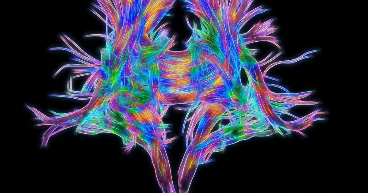 Most neurons seem to be jacks-of-all-trades, not specialists