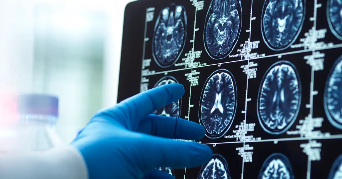 Pill that lowers oxygen levels in brain may ease Parkinson’s symptoms
