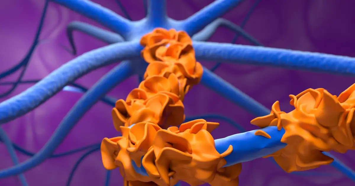 First-of-kind Guillain-Barré drug switches off part of immune system