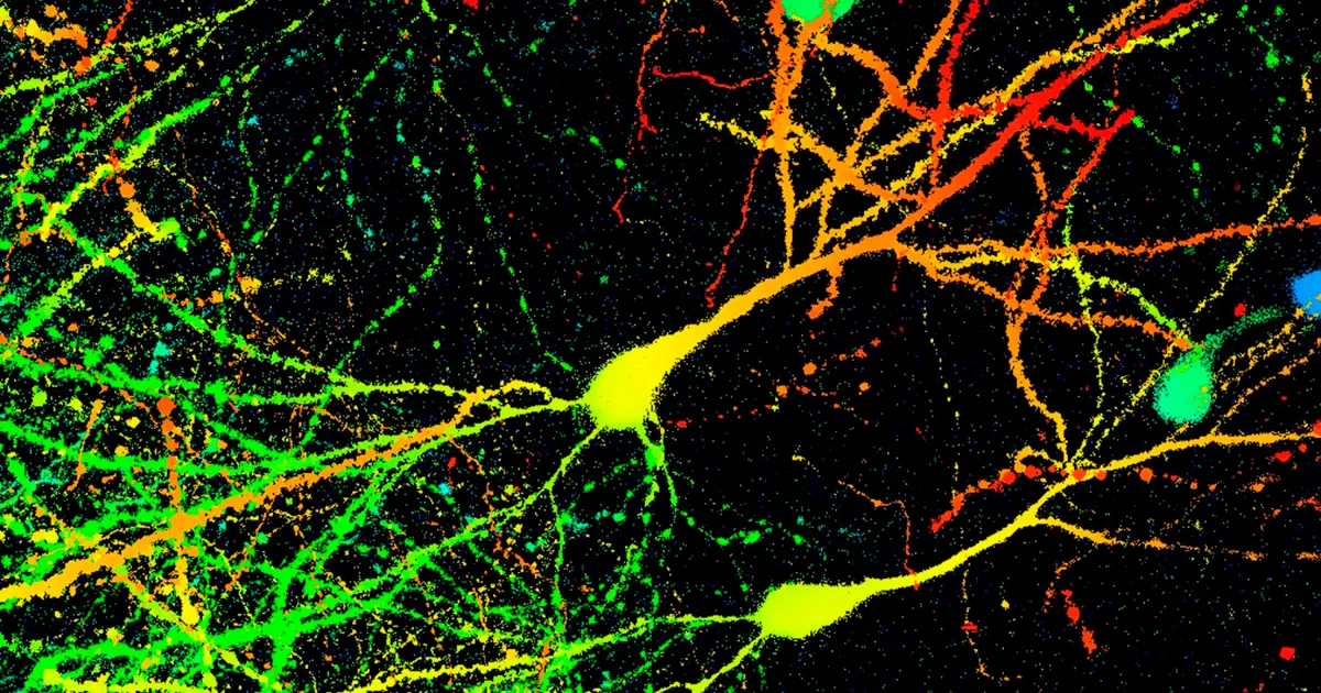 ‘Remarkable’ discovery upends our understanding of how brains store memories
