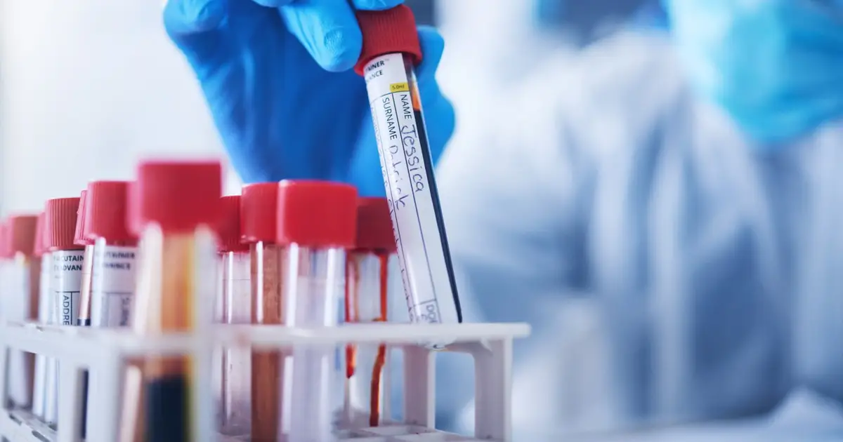 Our blood’s body clock may be causing anaemia cases to be missed