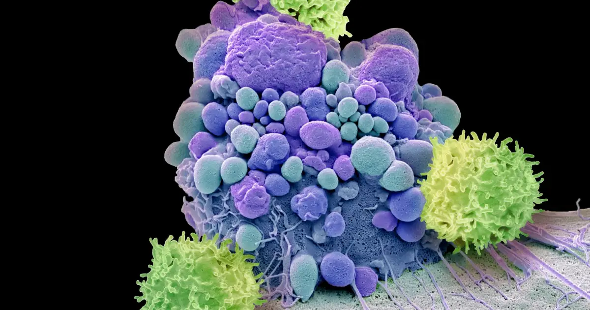 Newly-discovered immune hubs in our skull may keep our brain healthy