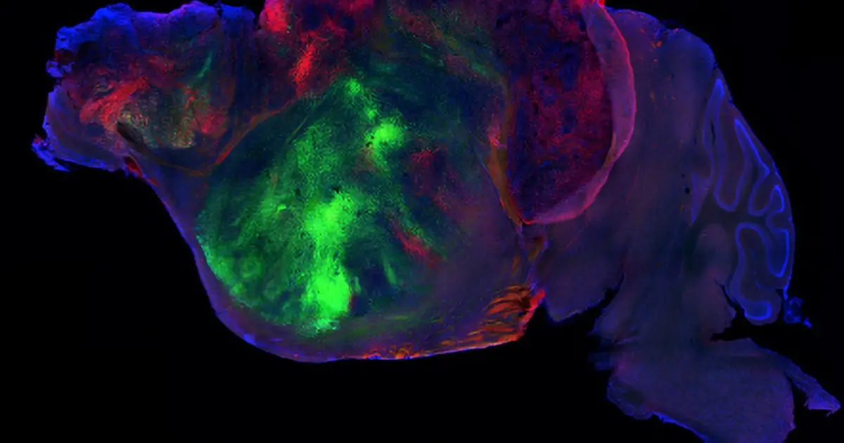 Human organoids restore cognition in mice with half a brain