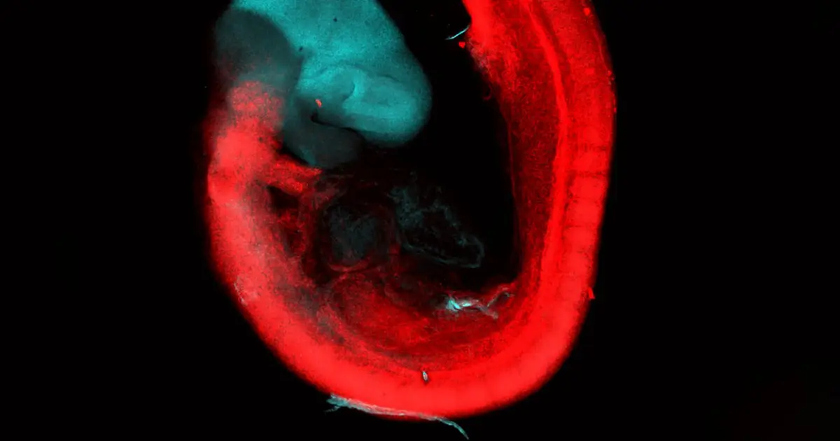 Our brain evolved from two primitive nervous systems that merged