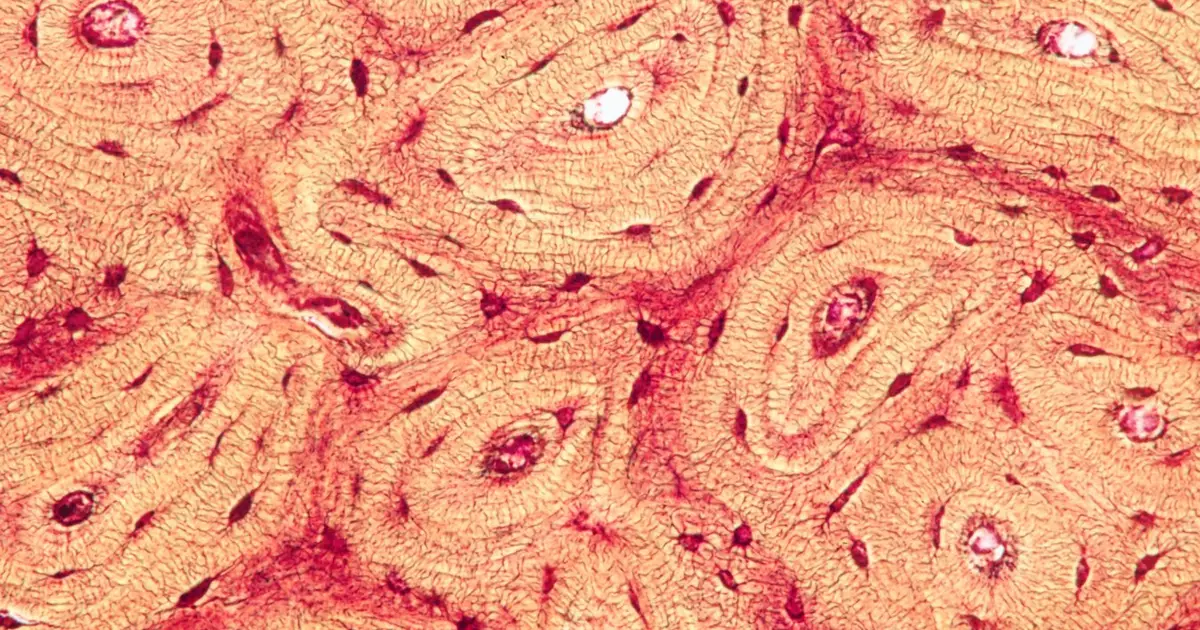 Compressing bones releases molecules that ease traumatic brain injuries