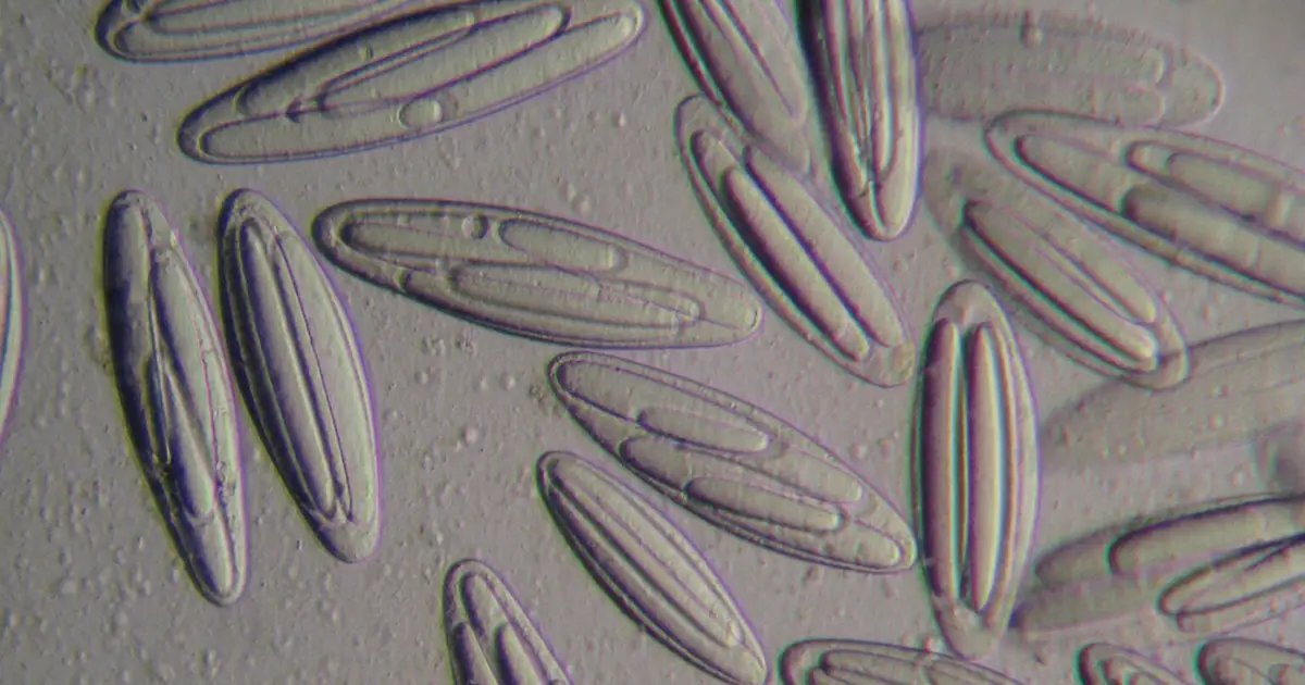 Giant bacteria could be living in your gut