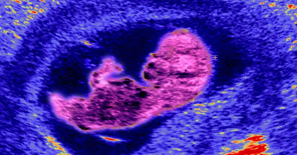 Cells from your mother could stay in your brain your whole life