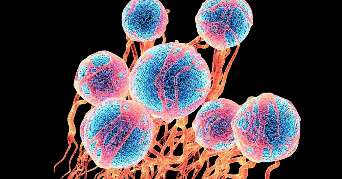 Common Sugar Appears to Loosen Cancer Cells And Help Them Spread