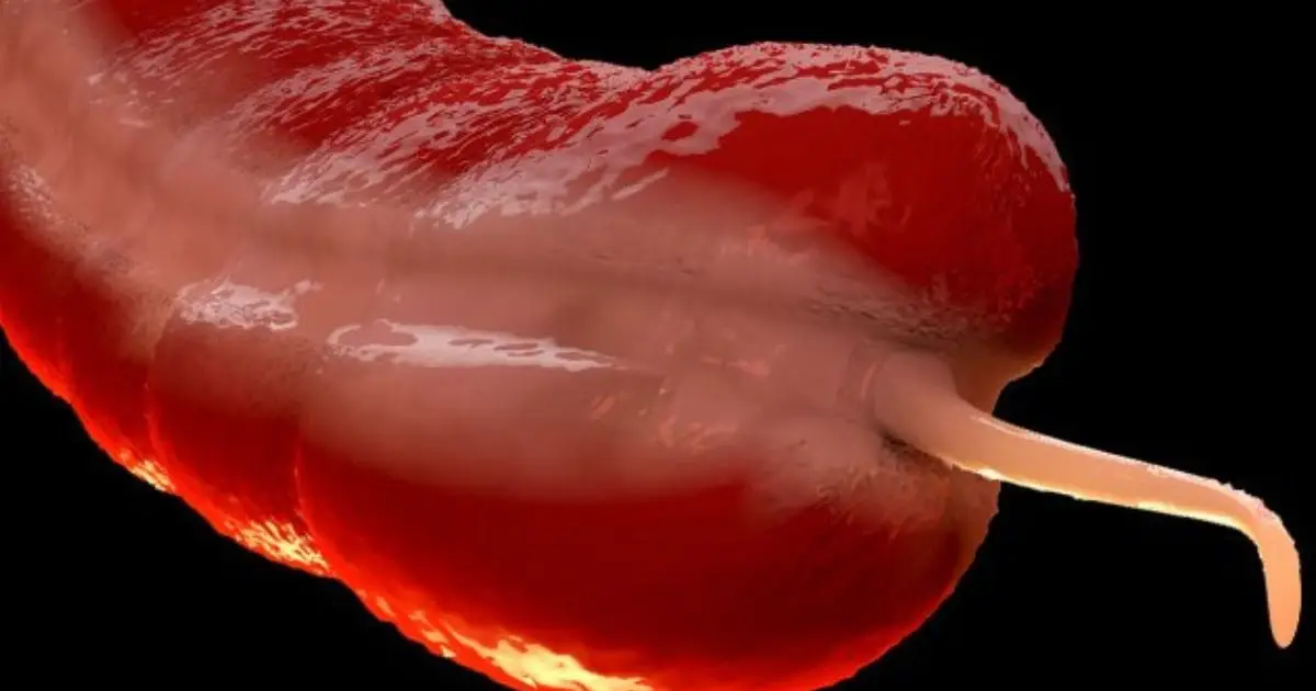 A Rare Cancer Is Surging in Young People, And Experts Don't Know Why