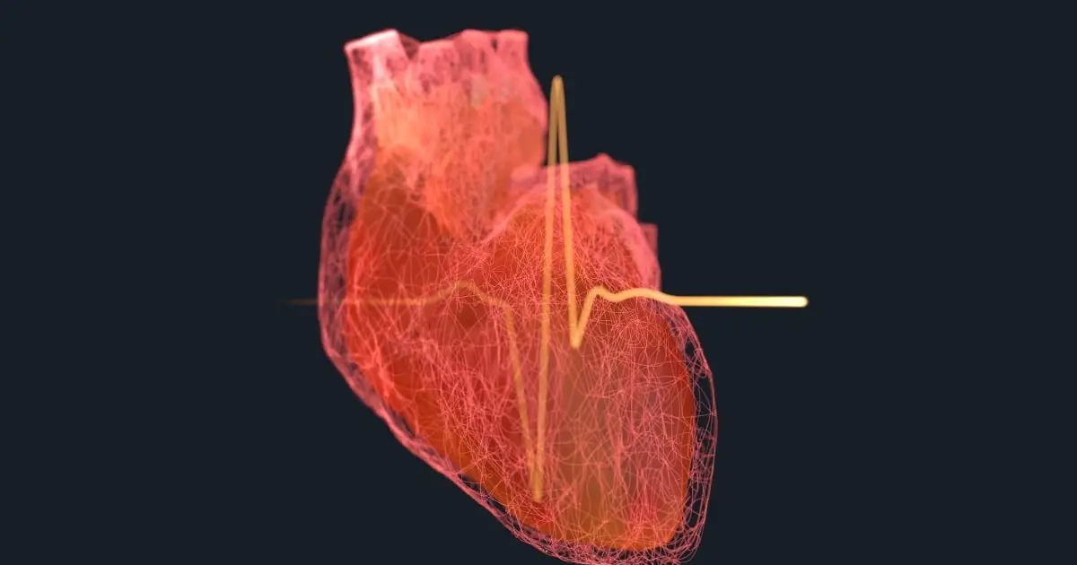 Major Study Links 99% of Heart Attacks And Strokes With 4 Risk Factors