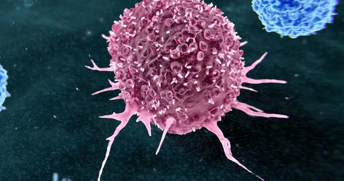Almost 50% of Preventable Cancers Linked to Just Two Lifestyle Habits
