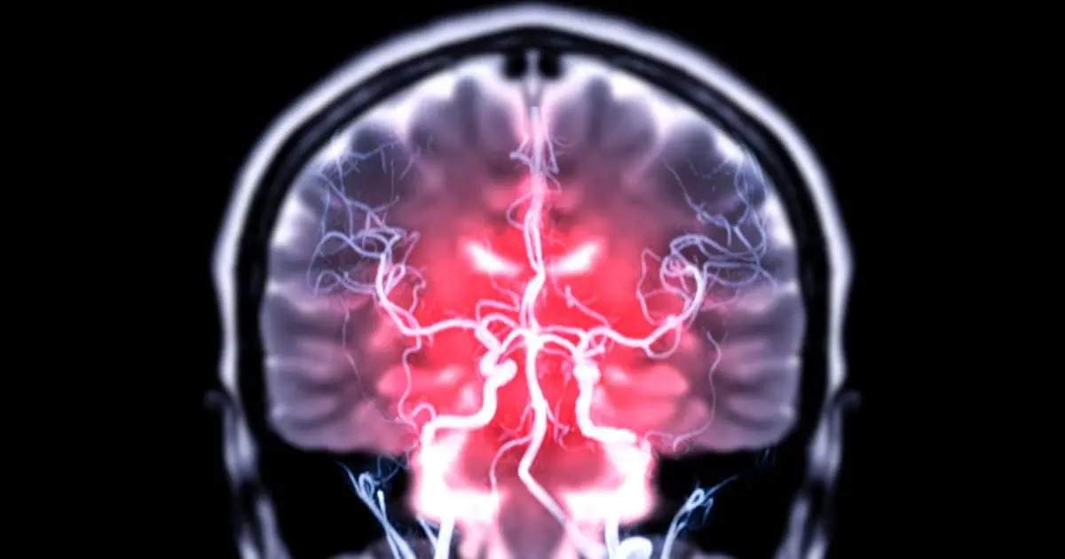 One Brain Chemical May Be Key to Breaking a Habit, Study Finds