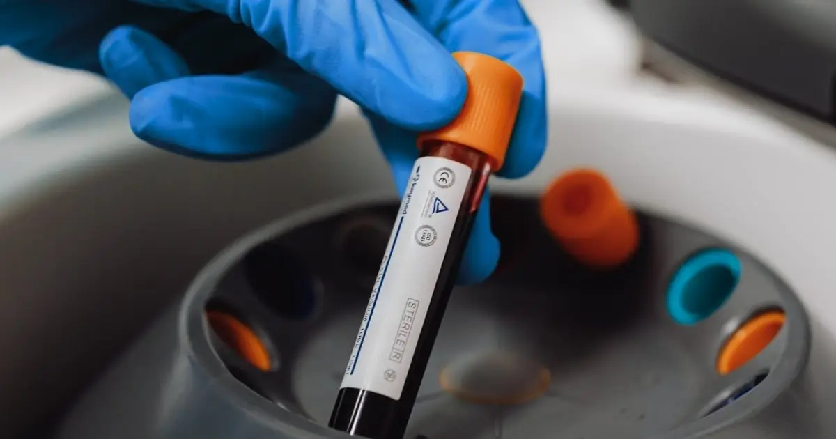 'Forever Chemicals' Found in 98.8% of Human Blood Samples Tested