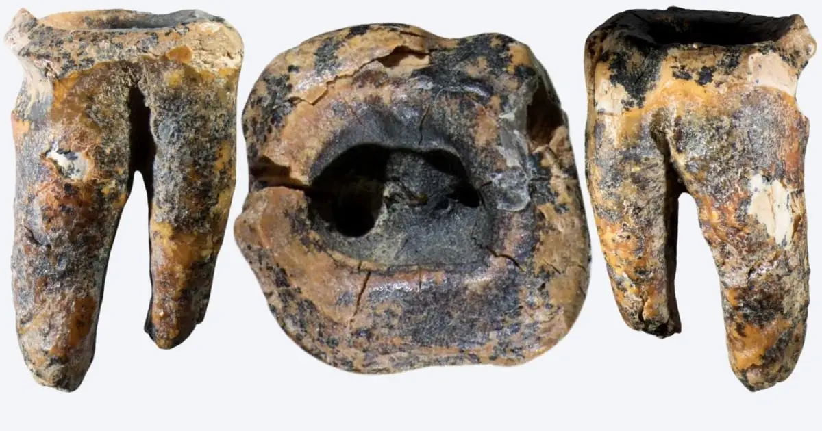 The Earliest Known Dentistry Wasn't Done By Our Species