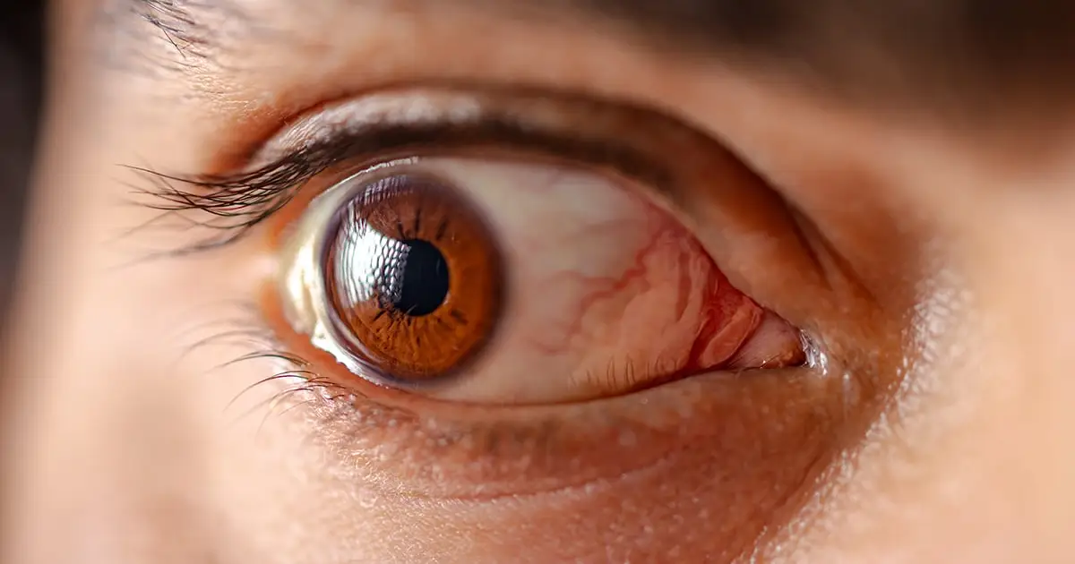 China Just Let AI Run an Eye Clinic. Here's What Happened.