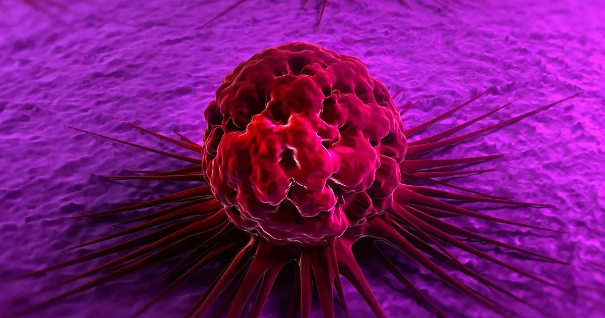 Low Testosterone Is Linked to a Higher Risk of Cancer, Study Finds