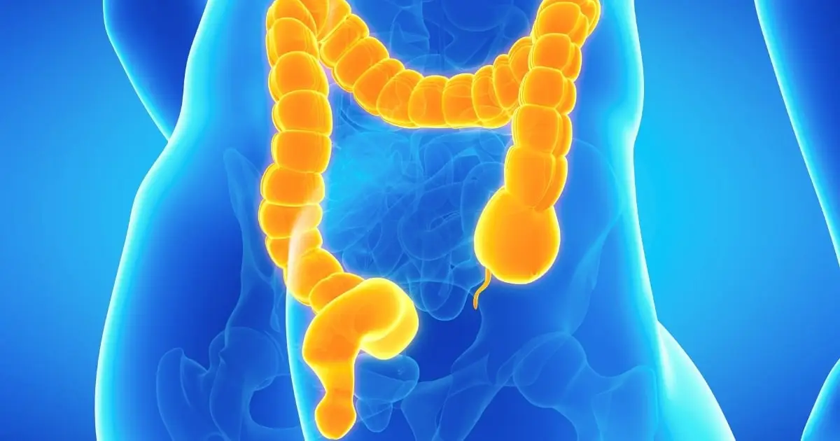 This Rare Bowel Condition Can Make Constipation Dangerous