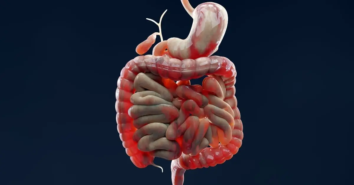 Scientists Solve a 30-Year Mystery Behind Inflammatory Bowel Disease