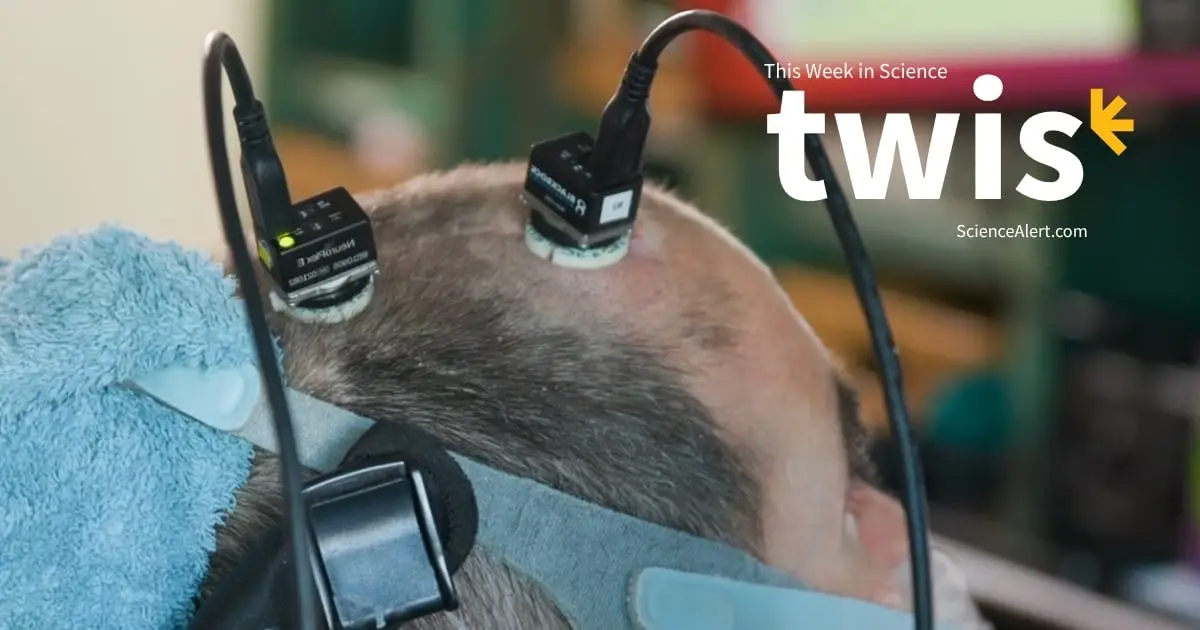This Week in Science: A Voice-Restoring Brain Implant, Nuclear Clocks, And More!