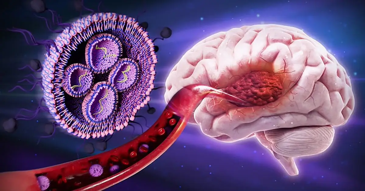 Sugar-Coated Nanoparticles Shrink Deadly Brain Tumors in Mice