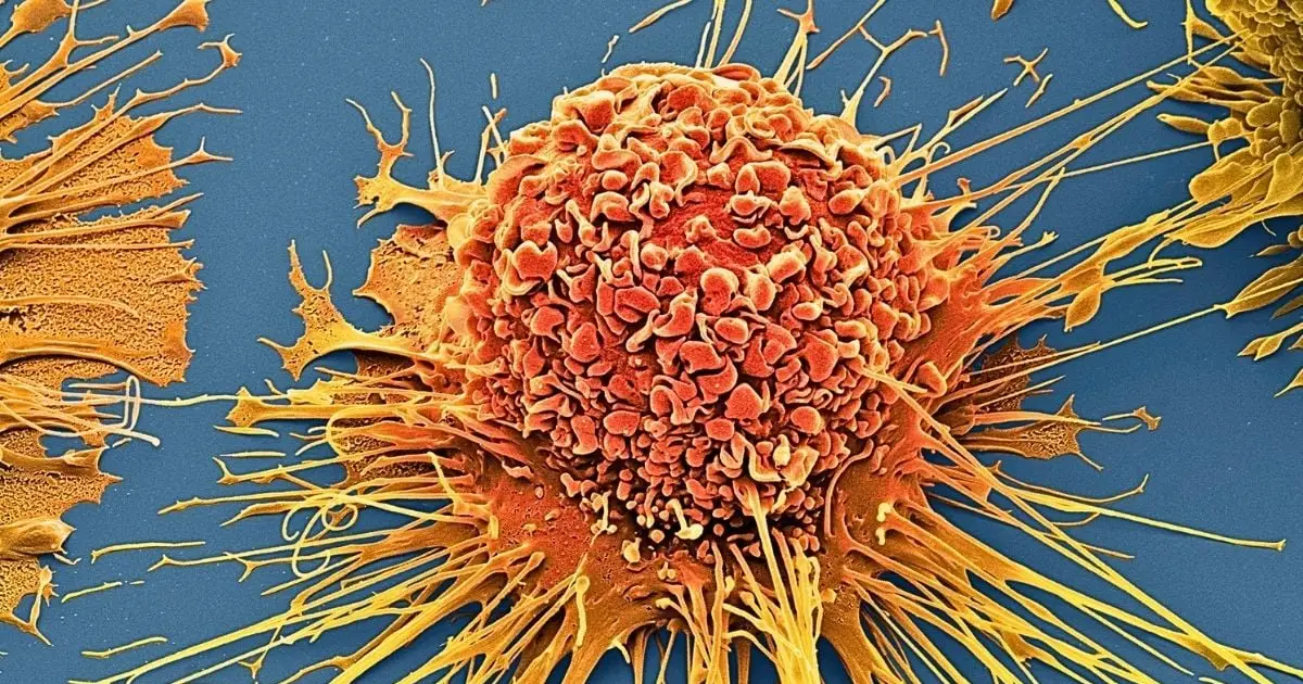 Scientists Destroy 99% of Cancer Cells in Lab Using Vibrating Molecules