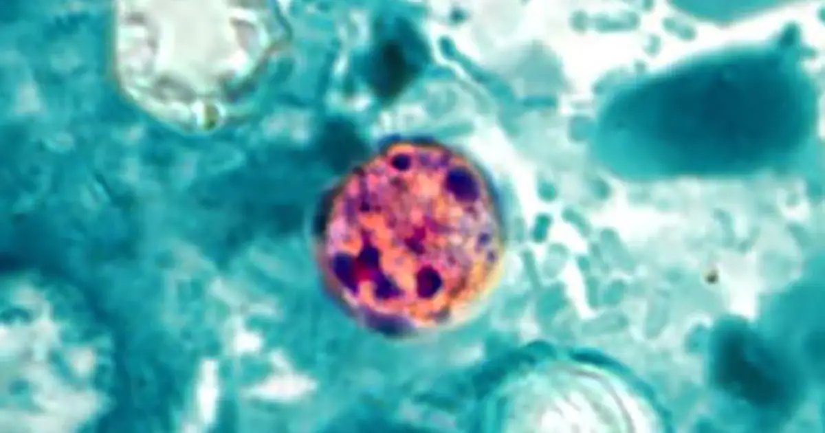 Explosive Diarrhea Is Surging Across The US Right Now