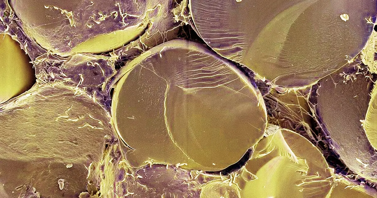 Crucial Fat Metabolism Switch Identified in Human Cells For First Time