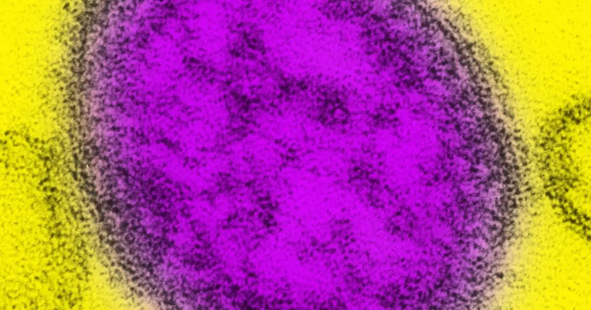 Measles Cases in The US Just Hit a 35-Year High. Here's What's Driving The Surge, And What You Need to Know